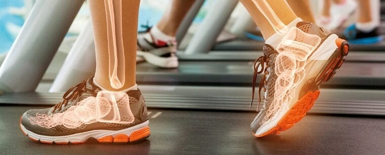 Gait Analysis 2x
