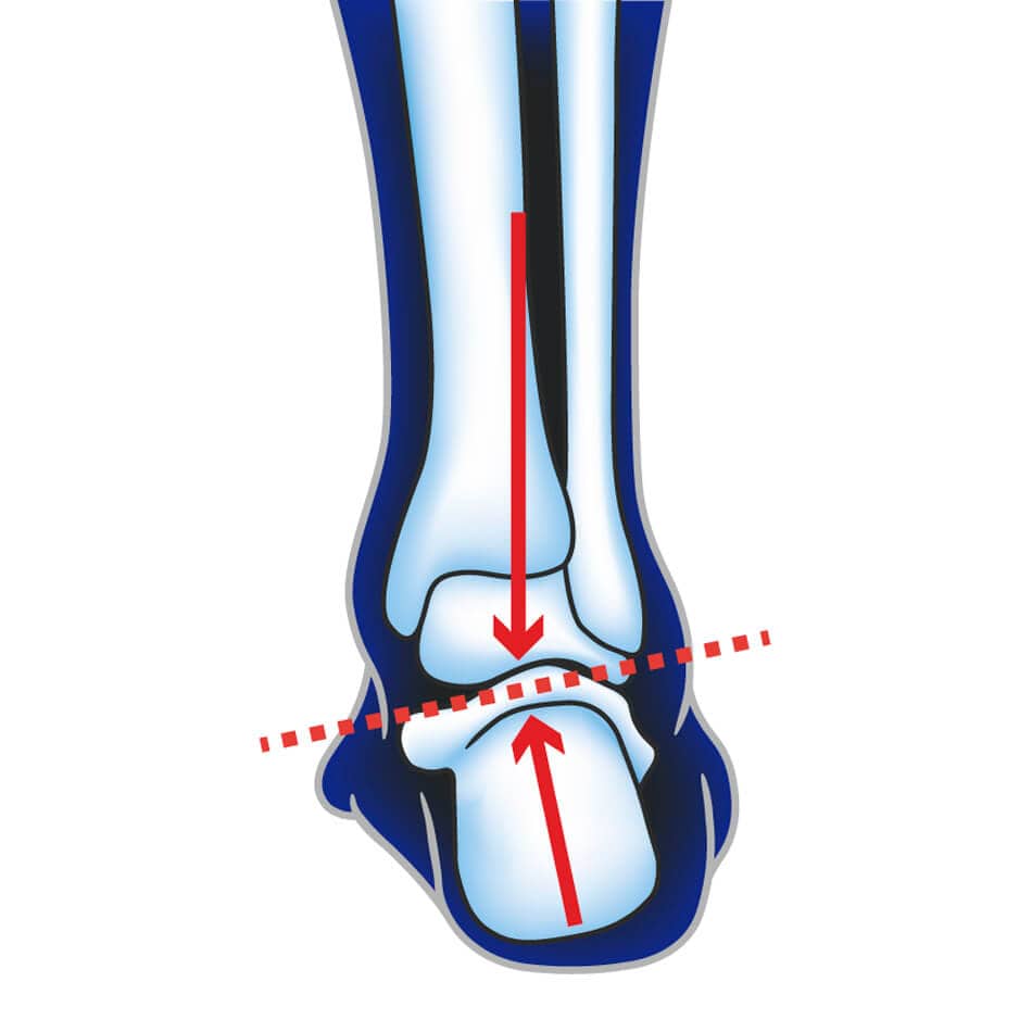 Ultimate Performance Accessories Ultimate Performance Advanced Insole With F3D AW23 - Up and Running